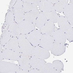 CXorf67 Antibody, Novus Biologicals 25 &mu;L; Unlabeled:Antibodies, Polyclonal